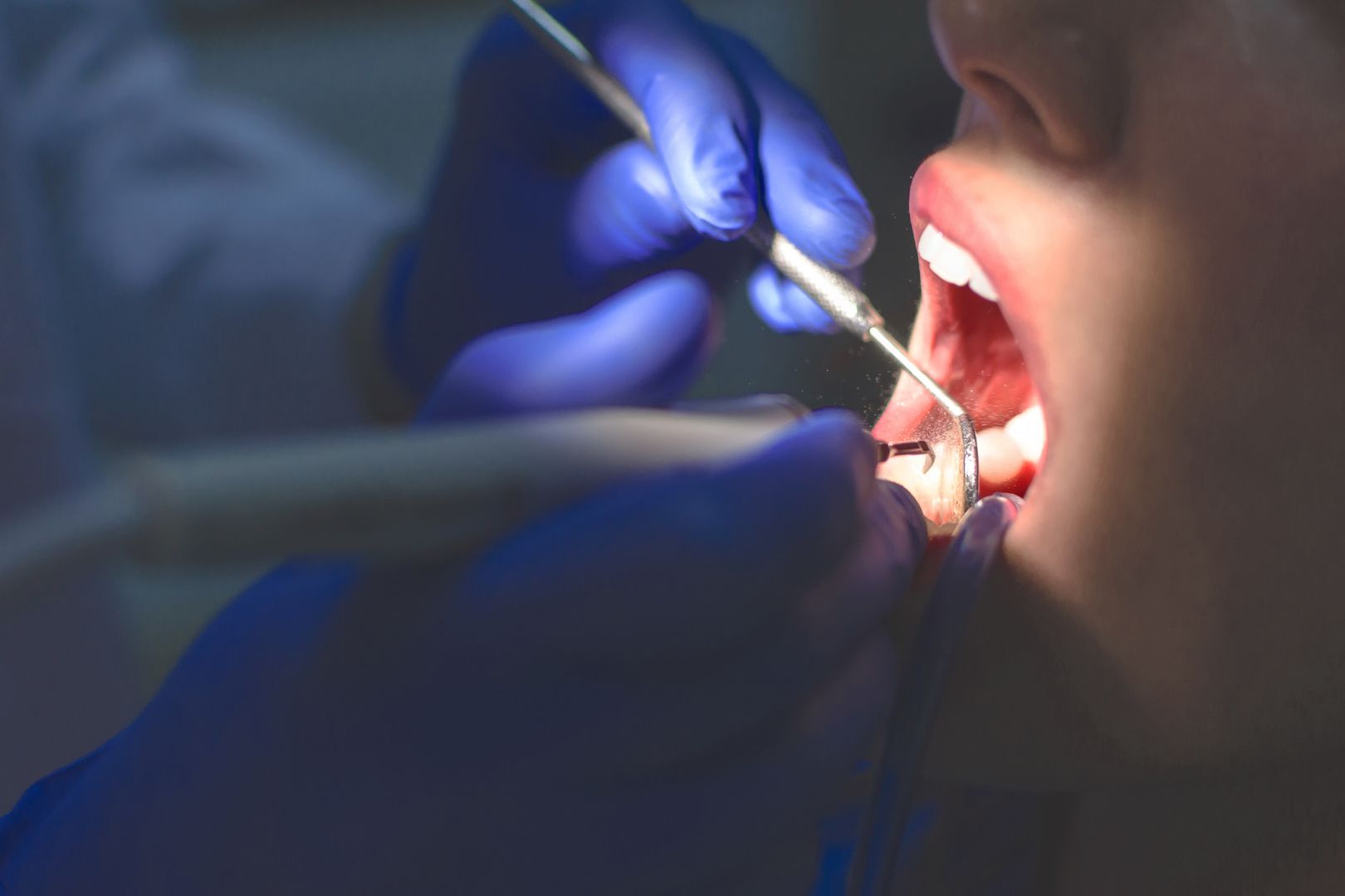 Como Escolher um Bom Dentista Perto de Casa